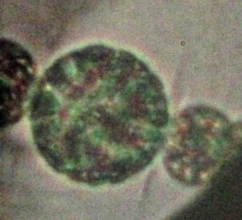 Akinete of Dolichospermum smithii